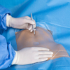 Laparoscopy Drape